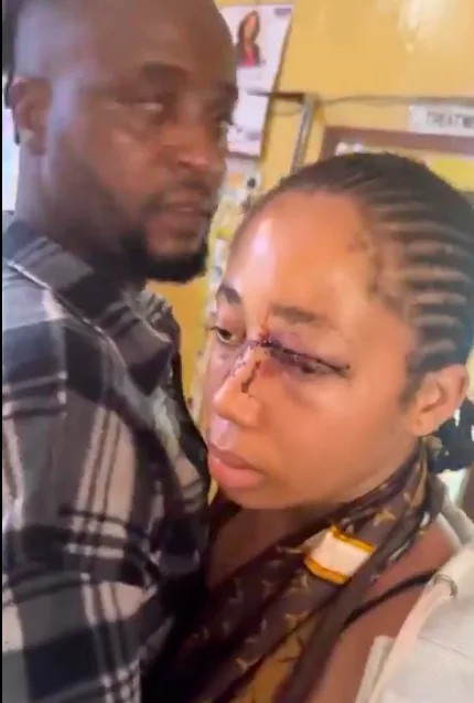 Wife receiving treatment over domestic violence pleads against husband’s arrest